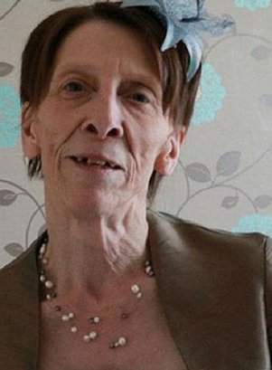 Η 18χρονη που μοιάζει με πενηντάρα -Στα 16 έκανε το πρώτο της λίφτινγκ [εικόνες]  | iefimerida.gr 3