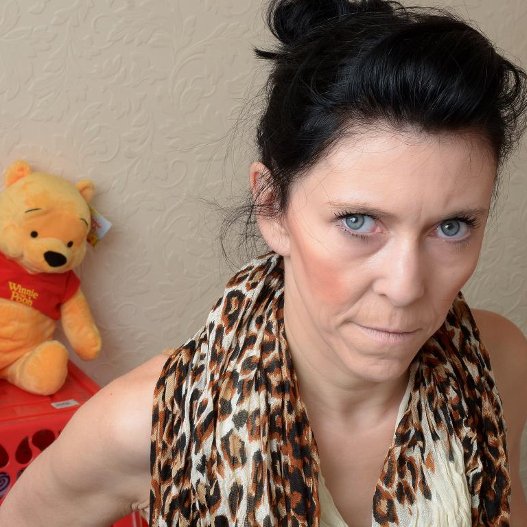 Η 18χρονη που μοιάζει με πενηντάρα -Στα 16 έκανε το πρώτο της λίφτινγκ [εικόνες]  | iefimerida.gr 2