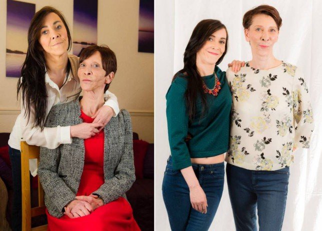 Η 18χρονη που μοιάζει με πενηντάρα -Στα 16 έκανε το πρώτο της λίφτινγκ [εικόνες]  | iefimerida.gr 5