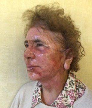 Αλλαξε η ζωή της: 80χρονη γιαγιά κάνει πλαστική ομορφιάς [εικόνες] | iefimerida.gr 5
