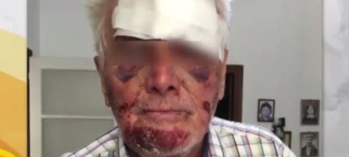 Φρίκη στο Γαλάτσι: Ληστές μαχαίρωσαν και χτύπησαν 90χρονο για 5 ευρώ [εικόνες] | iefimerida.gr 0