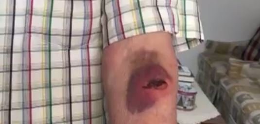 Φρίκη στο Γαλάτσι: Ληστές μαχαίρωσαν και χτύπησαν 90χρονο για 5 ευρώ [εικόνες] | iefimerida.gr 1