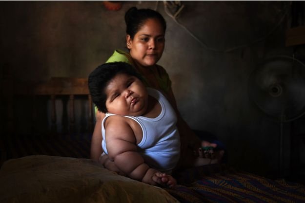 Ο εφιάλτης του Λουισίτο, ένα μωρό 10 μηνών που ζυγίζει 28 κιλά [εικόνες] | iefimerida.gr 2