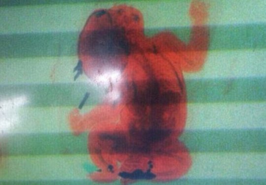 Εκρυψε το βρέφος της σε σακίδιο για να το περάσει από τον έλεγχο αεροδρομίου [εικόνες]  | iefimerida.gr 1