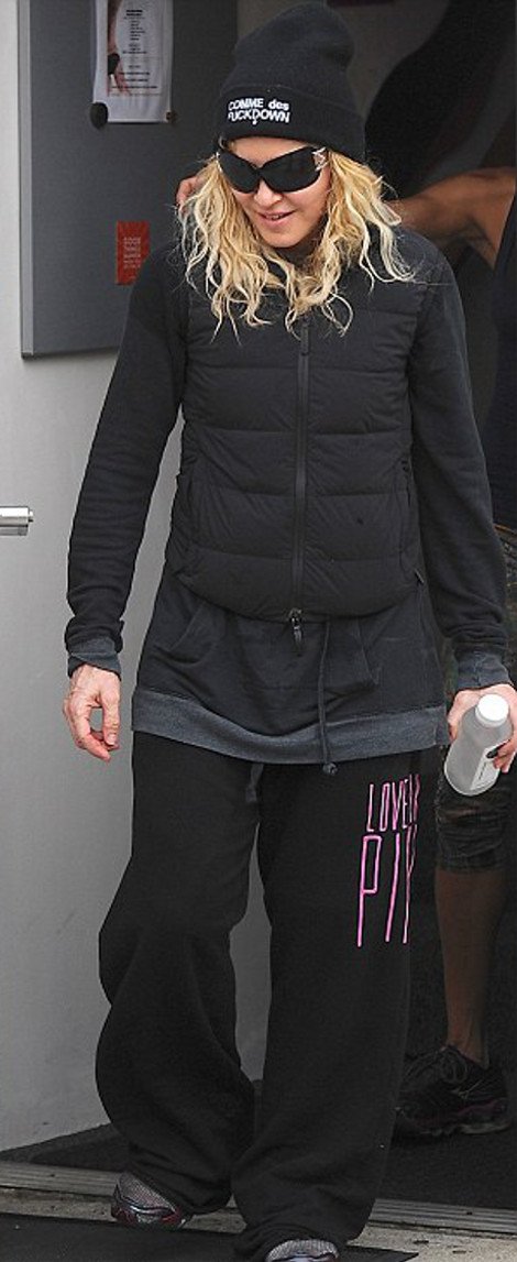 Αγνώριστη η  Madonna -Το πρόσωπό της μοιάζει με παραφουσκωμένο κέικ [εικόνες]  | iefimerida.gr 0