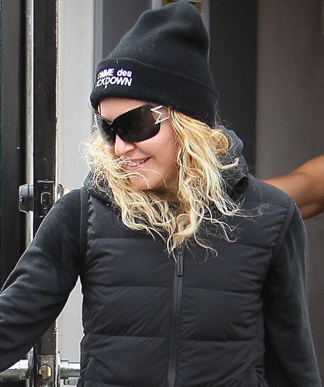 Αγνώριστη η  Madonna -Το πρόσωπό της μοιάζει με παραφουσκωμένο κέικ [εικόνες]  | iefimerida.gr 2