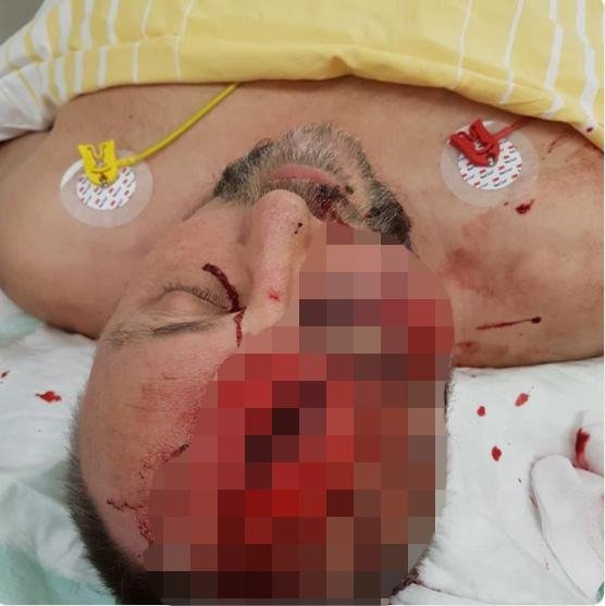 Το ακροδεξιό κόμμα δημοσίευσε φωτογραφία του βουλευτή αναίσθητου σε κρεβάτι νοσοκομείου (Φωτογραφία: Facebook)