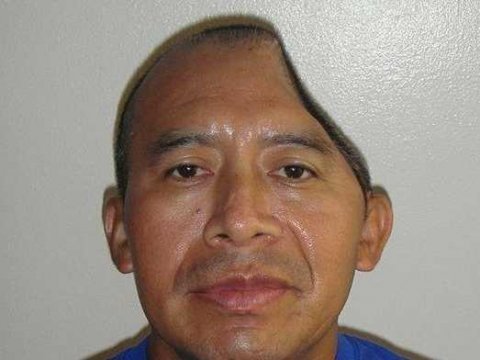 Δεν το χωράει ο νους: Μετανάστης χτυπήθηκε εξακολουθητικά στο κεφάλι και έχασε το μισό κρανίο του [εικόνα] | iefimerida.gr 0