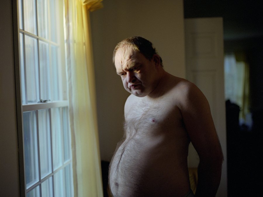 Ο σπαρακτικός αγώνας ενός ανθρώπου με τη σχιζοφρένεια -Ενα συγκλονιστικό φωτογραφικό ντοκιμαντέρ [εικόνες]  | iefimerida.gr 1