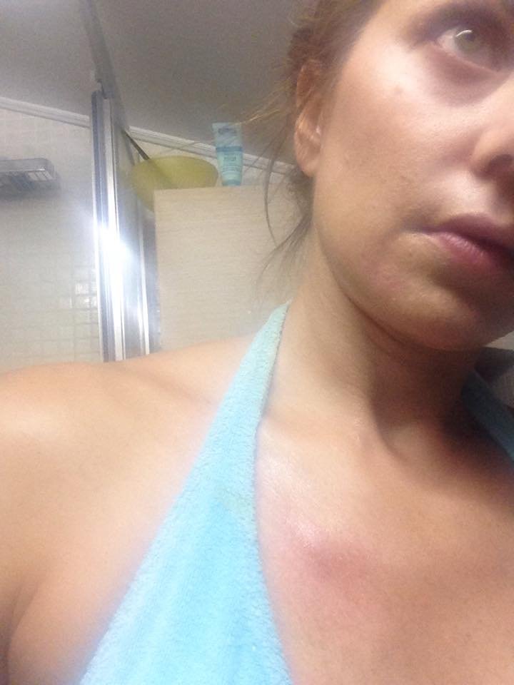 Το ατύχημα της Ευγενίας Μανωλίδου στο σπίτι [εικόνα] | iefimerida.gr 0