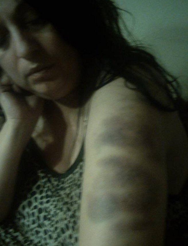 Ξυλοκόπησαν την υποψήφια δήμαρχο Θεσσαλονίκης Μαρία Ιωαννίδου -Aποσύρει την υποψηφιότητά της [εικόνες] | iefimerida.gr 0