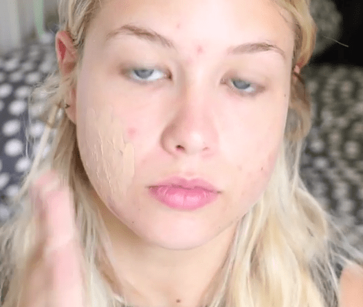 Διηγείται το bulling που πέρασε και κερδίζει 300.000 ευρώ το χρόνο [εικόνες] | iefimerida.gr 0