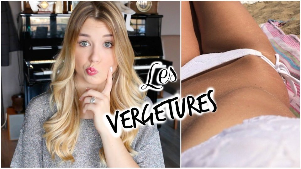 Διηγείται το bulling που πέρασε και κερδίζει 300.000 ευρώ το χρόνο [εικόνες] | iefimerida.gr 2