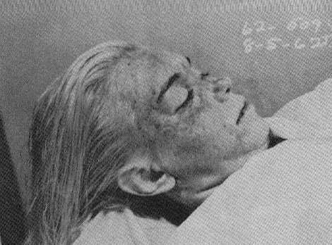 Διάσημα πτώματα στο τραπέζι του νεκροτομείου [εικόνες] | iefimerida.gr 6