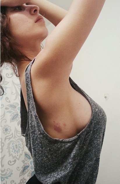 Κερδίζουν το Ιντερνετ: Ποστάρουν εικόνες τους με ελιές και κηλίδες στο πρόσωπό τους [εικόνες] | iefimerida.gr 0