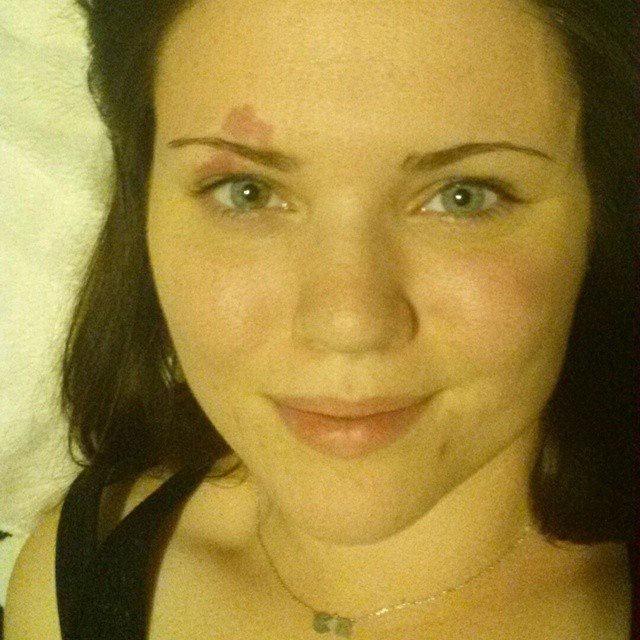 Κερδίζουν το Ιντερνετ: Ποστάρουν εικόνες τους με ελιές και κηλίδες στο πρόσωπό τους [εικόνες] | iefimerida.gr 3