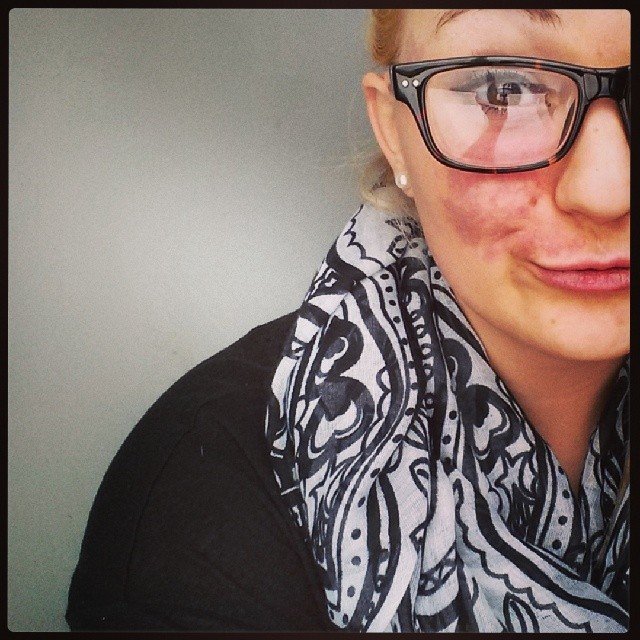 Κερδίζουν το Ιντερνετ: Ποστάρουν εικόνες τους με ελιές και κηλίδες στο πρόσωπό τους [εικόνες] | iefimerida.gr 9