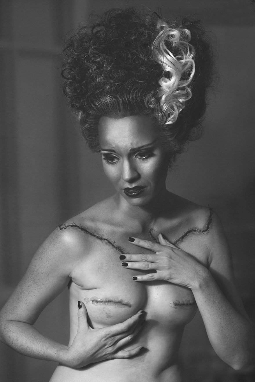 Ηθοποιός φωτογράφισε κάθε στάδιο της μαστεκτομής της, αλλιώς - Με ειλικρίνεια αλλά και χιούμορ [εικόνες] | iefimerida.gr 2