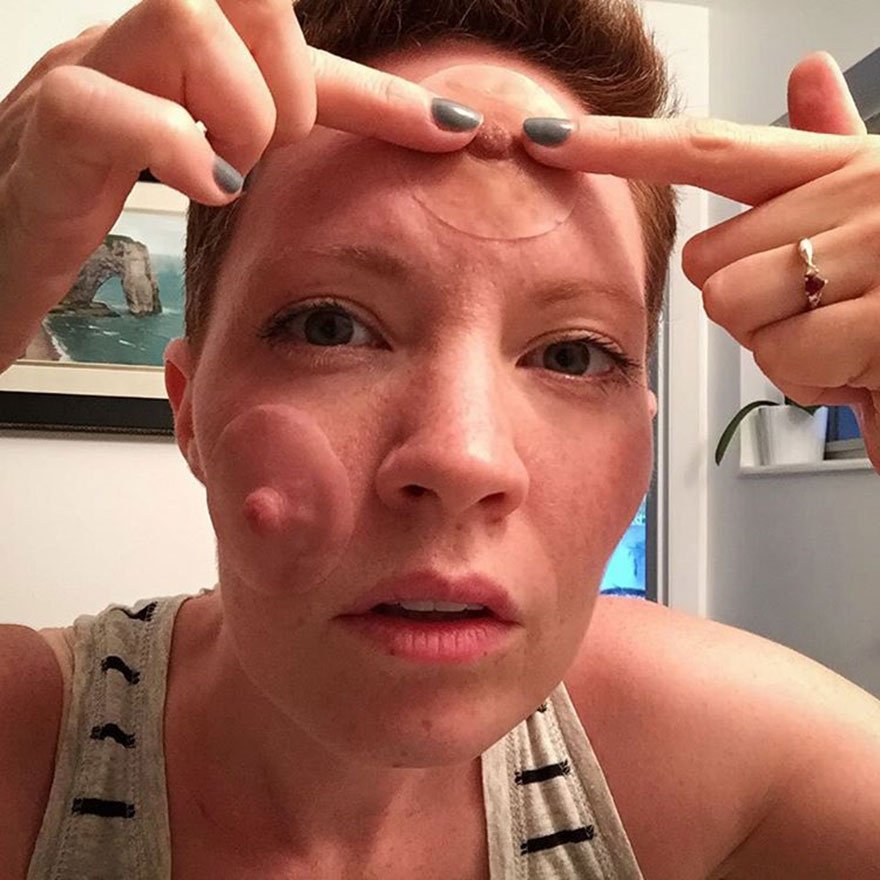 Ηθοποιός φωτογράφισε κάθε στάδιο της μαστεκτομής της, αλλιώς - Με ειλικρίνεια αλλά και χιούμορ [εικόνες] | iefimerida.gr 6