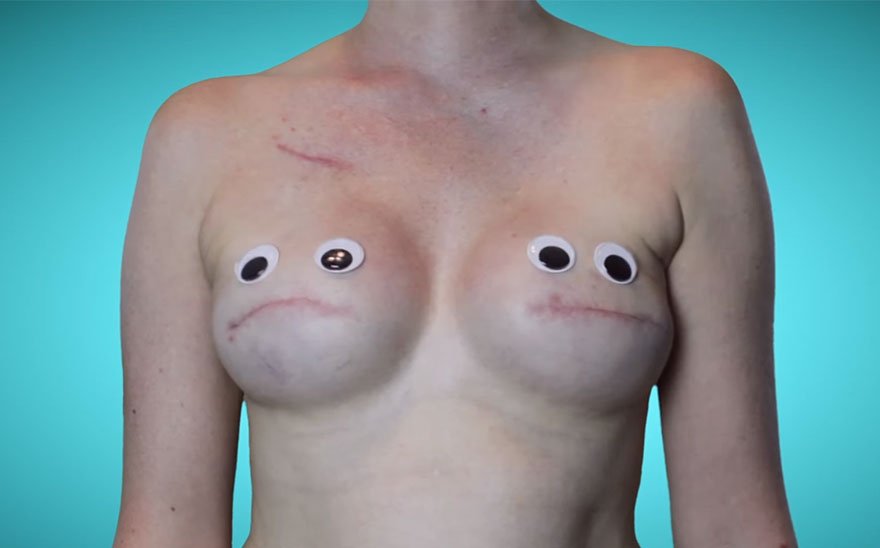 Ηθοποιός φωτογράφισε κάθε στάδιο της μαστεκτομής της, αλλιώς - Με ειλικρίνεια αλλά και χιούμορ [εικόνες] | iefimerida.gr 7