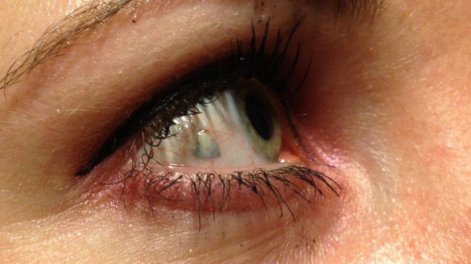 Ανατριχιαστική μόδα που προκαλεί αντιδράσεις-Ερχεται το piercing στο ...μάτι [εικόνες] | iefimerida.gr 0