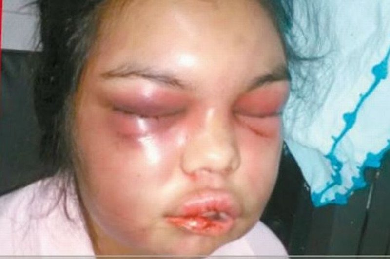 Σκληρό: Εδερνε τη γυναίκα του για κάθε like που έπαιρνε στο Facebook [εικόνες] | iefimerida.gr 0