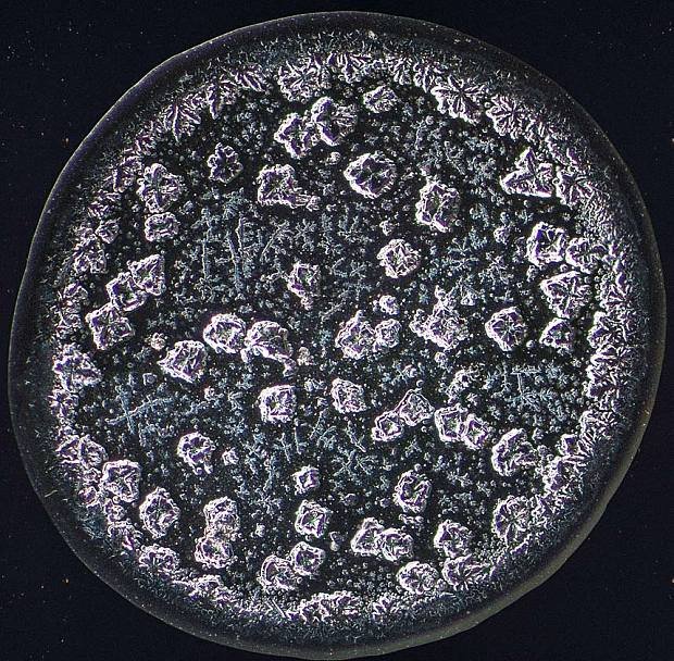 Ετσι μοιάζουν τα δάκρυα στο μικροσκόπιο [εικόνες] | iefimerida.gr 0