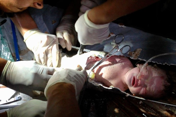 Oι φωτογραφίες που μας σόκαραν ή μας εξέπληξαν το 2013- Ηταν μια ασυνήθιστη χρονιά [εικόνες] | iefimerida.gr 6