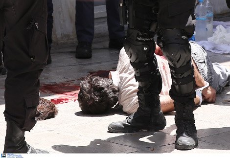 Καρέ καρέ η μεταφορά του αιμόφυρτου Νίκου Μαζιώτη μετά την ανταλλαγή πυροβολισμών στο κέντρο της Αθήνας [εικόνες] | iefimerida.gr 13