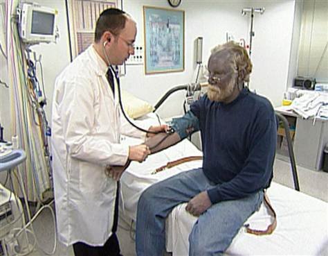 Πέθανε ο περίφημος «μπλε άνθρωπος»- Ο Πολ Κάρασον είχε σοκάρει λόγω του παράξενου χρώματος που είχε αποκτήσει το δέρμα του [βίντεο + εικόνες] | iefimerida.gr 1