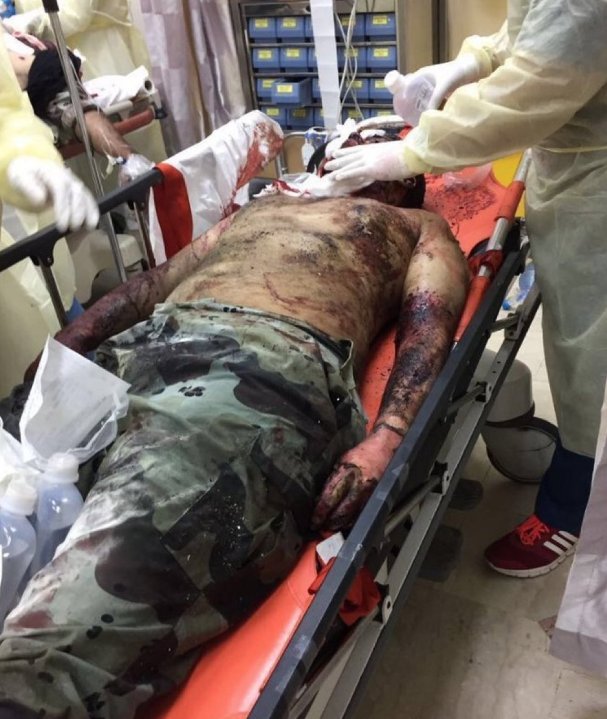 Βομβιστής αυτοκτονίας χτύπησε το τζαμί του Μωάμεθ στην Μεδίνα -Τουλάχιστον 4 νεκροί [εικόνες & βίντεο] | iefimerida.gr 2