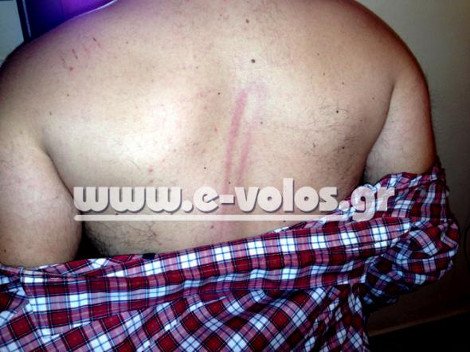 Βουλευτής ΣΥΡΙΖΑ: Πήγα στο γήπεδο και τα ΜΑΤ με έδειραν [βίντεο&εικόνες] | iefimerida.gr 0