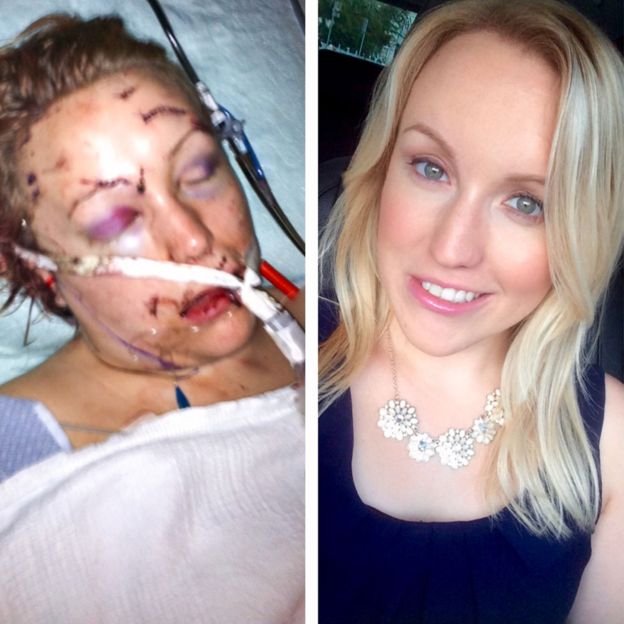 Ζωή σαν ταινία: Tη μαχαίρωσε 32 φορές ο πρώην της, επέζησε και παντρεύτηκε τον πυροσβέστη που την έσωσε [εικόνες] | iefimerida.gr 1