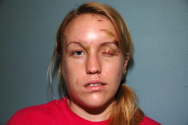 Ζωή σαν ταινία: Tη μαχαίρωσε 32 φορές ο πρώην της, επέζησε και παντρεύτηκε τον πυροσβέστη που την έσωσε [εικόνες] | iefimerida.gr 2