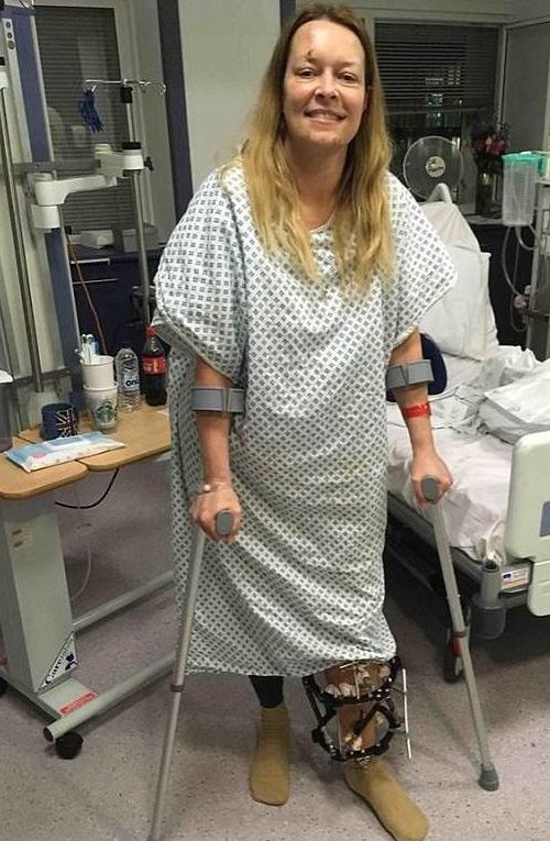 Η γυναίκα από τις φωτογραφίες-σοκ μετά το χτύπημα στο Λονδίνο χαμογελά ξανά [εικόνες] | iefimerida.gr 0