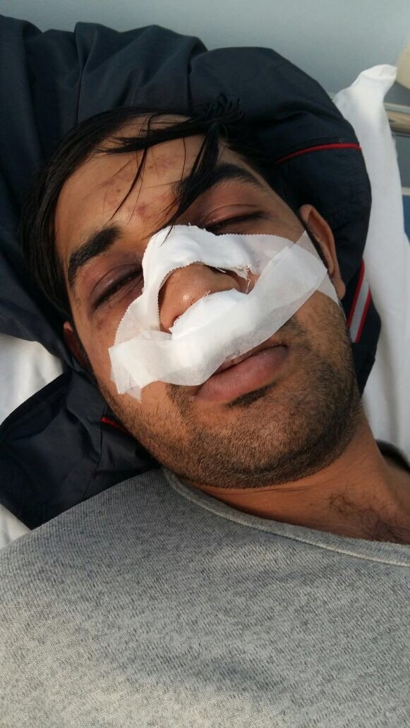 Νέα  επίθεση σε μετανάστη: Τον λίντσαραν, έπεσαν επάνω του και τον χτυπούσαν σαν αγέλη [εικόνες] | iefimerida.gr 0