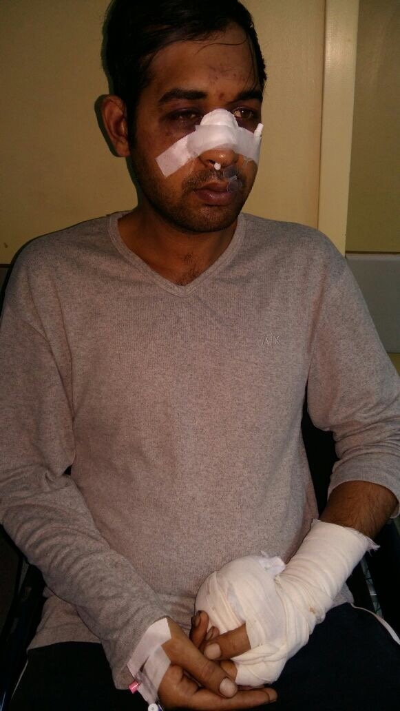 Νέα  επίθεση σε μετανάστη: Τον λίντσαραν, έπεσαν επάνω του και τον χτυπούσαν σαν αγέλη [εικόνες] | iefimerida.gr 1