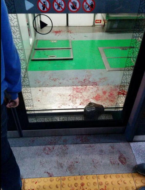 Νέο χτύπημα στη Νότιο Κορέα -Σύγκρουση στο μετρό με 170 τραυματίες [εικόνες] | iefimerida.gr 5