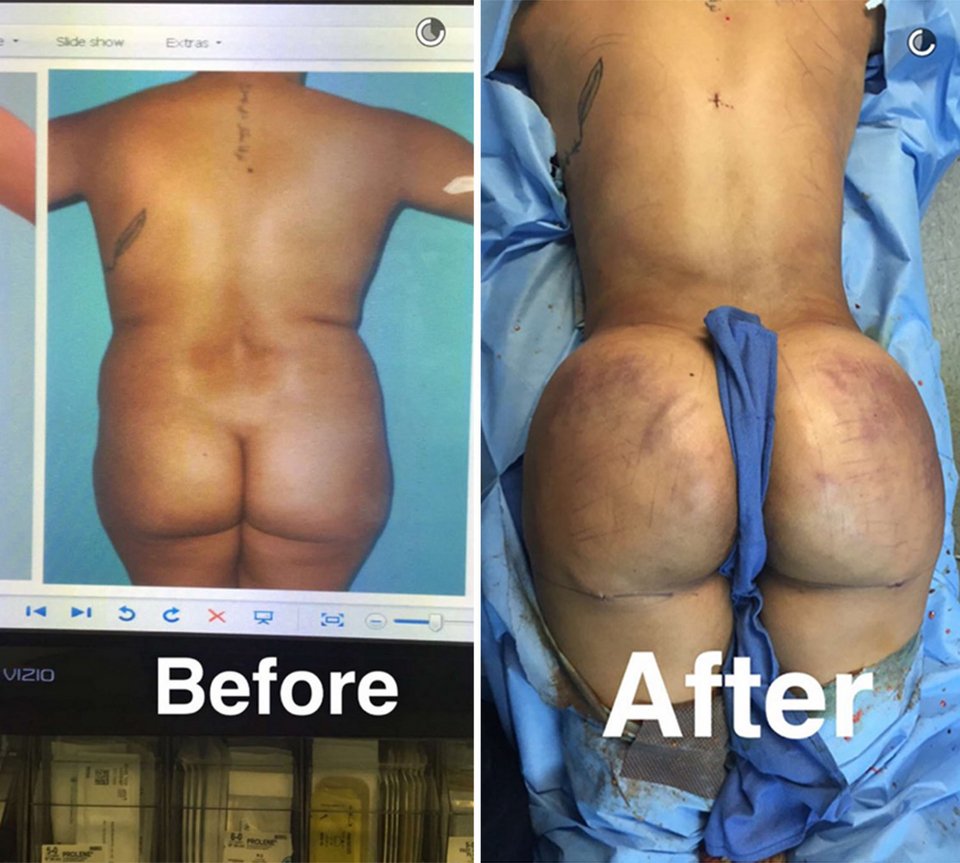 Πλαστικός «σφάζει» γυναίκες και ανεβάζει τις εικόνες ζωντανά [σκληρές εικόνες] | iefimerida.gr 1