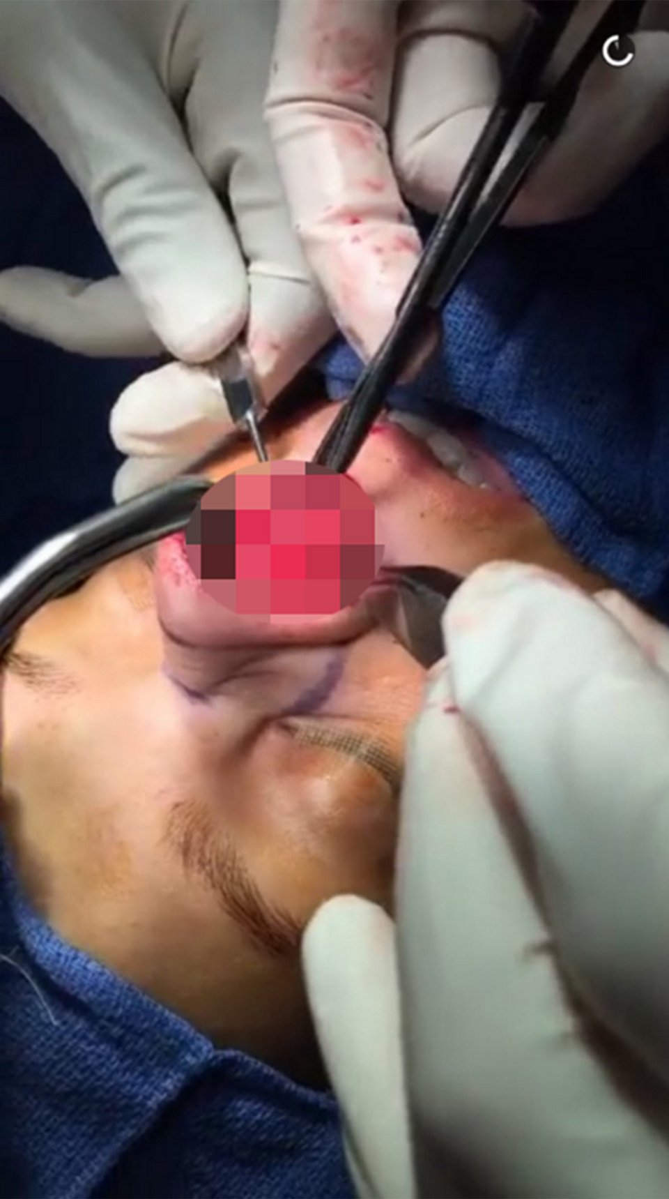 Πλαστικός «σφάζει» γυναίκες και ανεβάζει τις εικόνες ζωντανά [σκληρές εικόνες] | iefimerida.gr 4