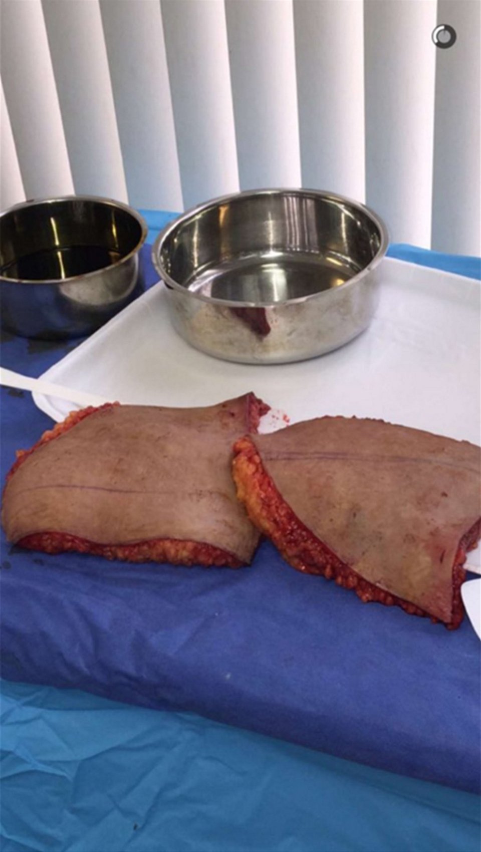 Πλαστικός «σφάζει» γυναίκες και ανεβάζει τις εικόνες ζωντανά [σκληρές εικόνες] | iefimerida.gr 5