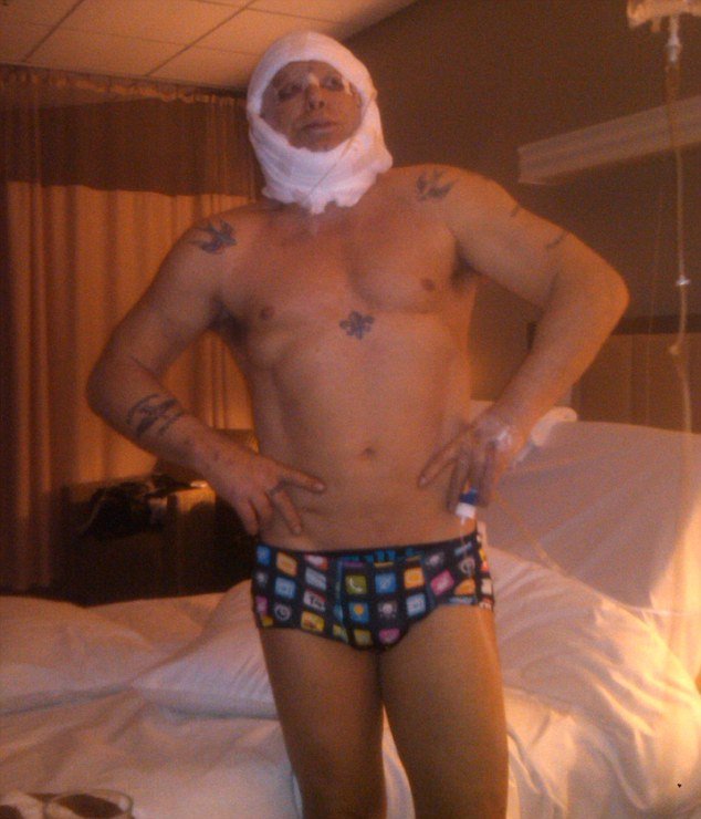 Σοκ-Ο Μίκυ Ρούρκ ποζάρει μπανταρισμένος, ακριβώς μετά την τελευταία του πλαστική [εικόνες]  | iefimerida.gr 0