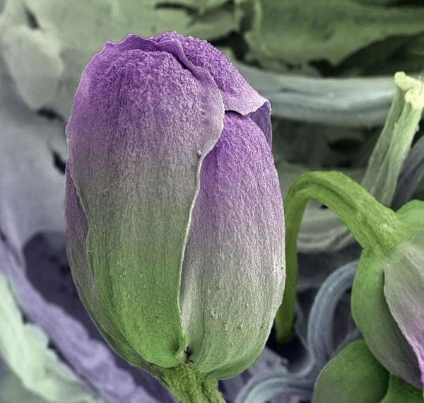 Πως είναι το φαγητό μας κάτω από το μικροσκόπιο [εικόνες]  | iefimerida.gr 2