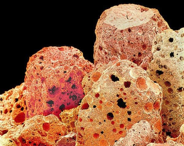 Πως είναι το φαγητό μας κάτω από το μικροσκόπιο [εικόνες]  | iefimerida.gr 1