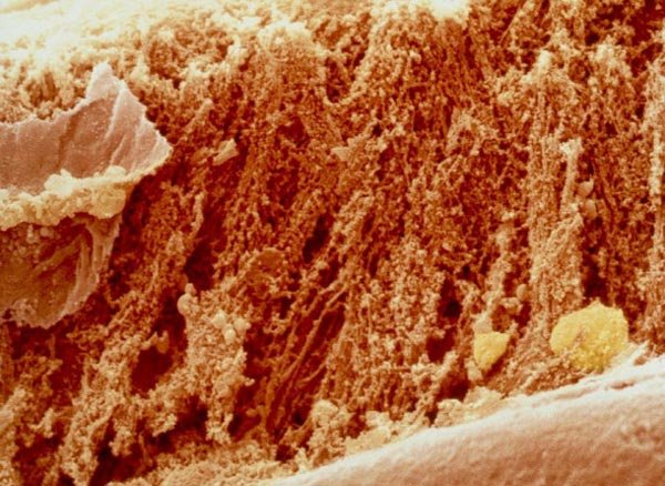 Πως είναι το φαγητό μας κάτω από το μικροσκόπιο [εικόνες]  | iefimerida.gr 3