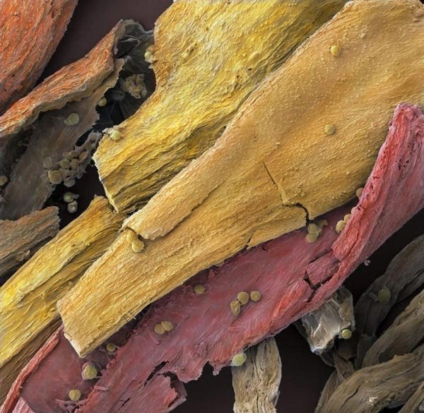 Πως είναι το φαγητό μας κάτω από το μικροσκόπιο [εικόνες]  | iefimerida.gr 7