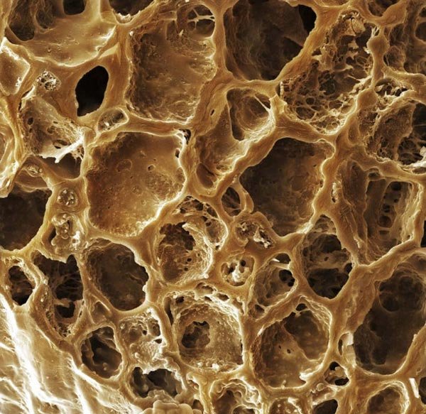 Πως είναι το φαγητό μας κάτω από το μικροσκόπιο [εικόνες]  | iefimerida.gr 8