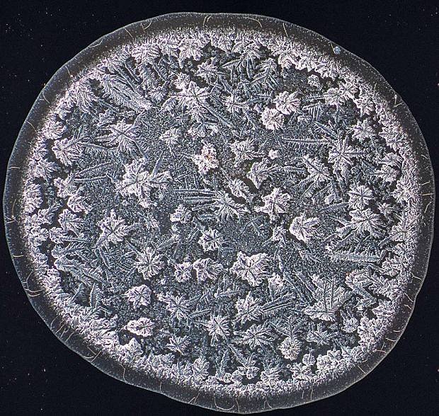 Ετσι μοιάζουν τα δάκρυα στο μικροσκόπιο [εικόνες] | iefimerida.gr 1