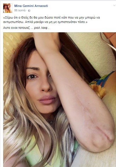 H Μίνα Αρναούτη δείχνει για πρώτη φορά τα σημάδια από το δυστύχημα με τον Παντελίδη και σοκάρει [εικόνα] | iefimerida.gr 0