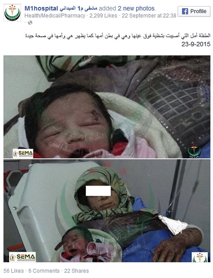 Συρία: Κοριτσάκι γεννήθηκε με θραύσμα οβίδας στο κεφάλι και έζησε [σκληρές εικόνες&βίντεο] | iefimerida.gr 3